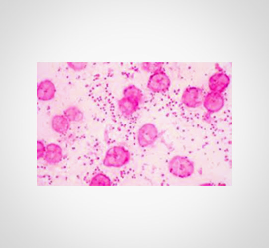 Encode Innovations LLP