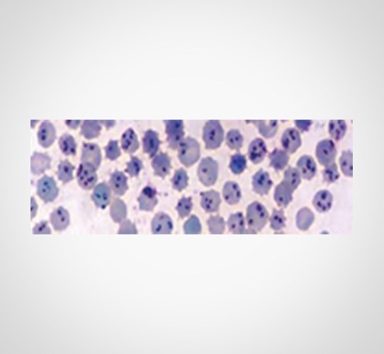 Encode Innovations LLP